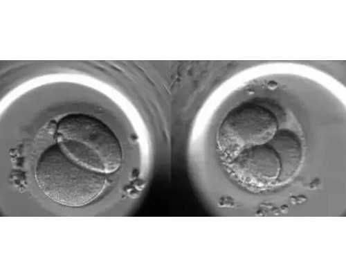 代孕选男女费用,多囊卵巢可以治好吗,进产房生孩