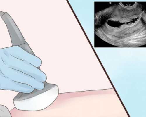 让宝宝的奶粉成健康成长的助力