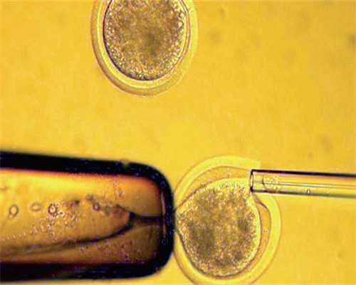 2026深圳哪些地方有提供供卵试管助孕技术