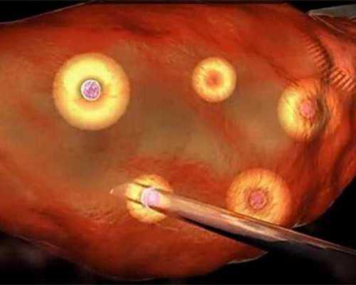 合肥安医试管怎么样