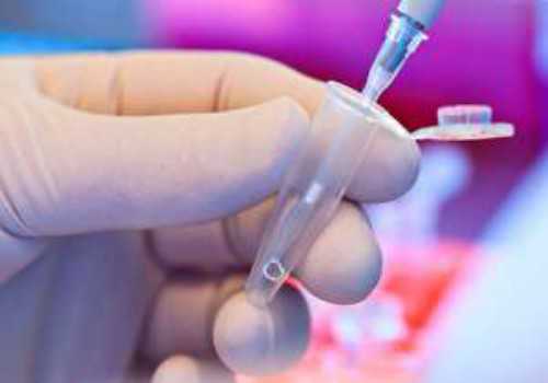 郑州高龄试管婴儿供卵哪些女性必须检查卵子质量？