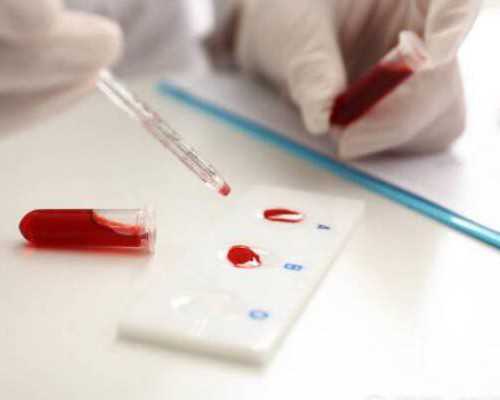 国内试管排名一览，寻网帮你快速收藏！