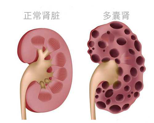 深圳助孕-深圳代怀孕是否违法-深圳提供代生小孩