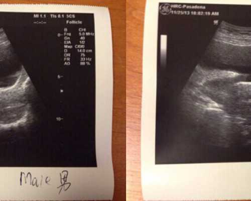 香港介绍人捐卵,香港供卵试管流程、费用及成功率介绍