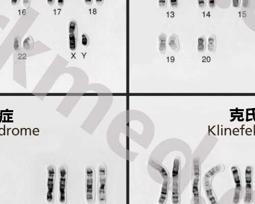 深圳提供代孕的公司有哪些_怀孕八个月胎动减少