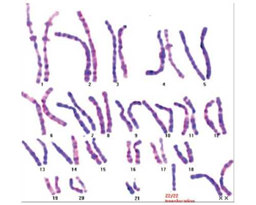 北京供卵试管公司排名，输卵管粘连可以供卵吗