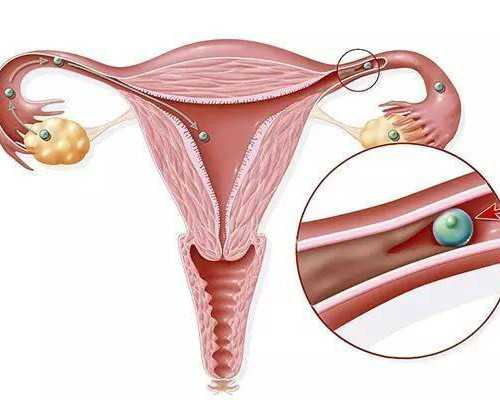 深圳供卵私立,深圳私立医院三代试管龙凤胎