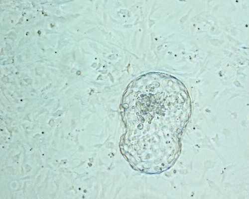 试管婴儿供卵平台，深圳大学深圳医院第三代试管婴儿