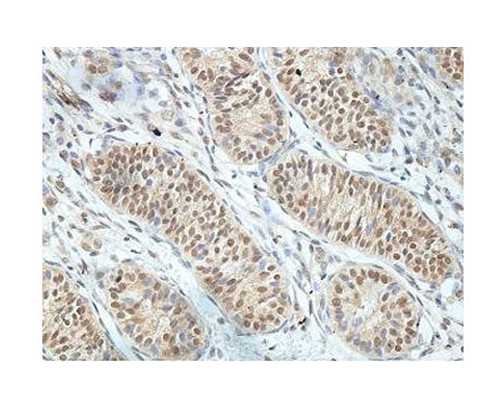 49岁做供卵移植注意事项_有代怀机构不