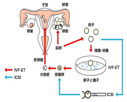 深圳助孕公司在哪,深圳公明试管婴儿公司-调查显示73%的不孕不育患者不排斥试
