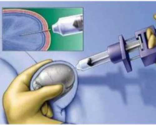 深圳代孕正规吗-深圳代孕全包多少-女性避孕方式哪个最好