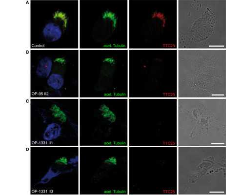 深圳代孕网_深圳代孕生男孩全包价_深圳亲戚代孕产子