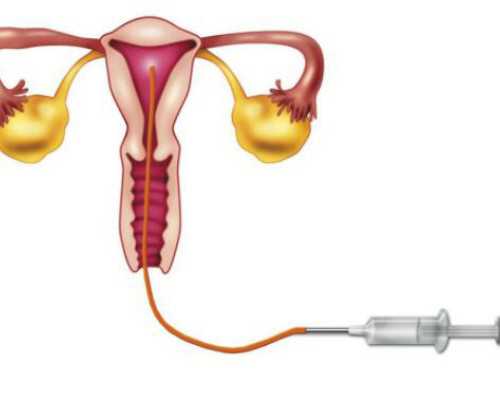 广州哪里代孕靠谱-广州代孕找亲戚怎么样【代孕无止境，相信科技的力量】
