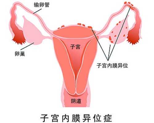 深圳供卵官方网站，供卵中介神州中泰官网
