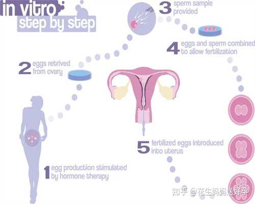 深圳借卵生子的身体条件,试管婴儿定方案是做b超吗？