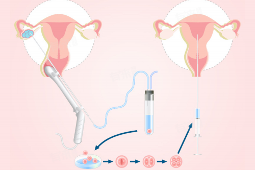 深圳代生子-深圳助孕妈妈哪里找-深圳求助孕机构的价格