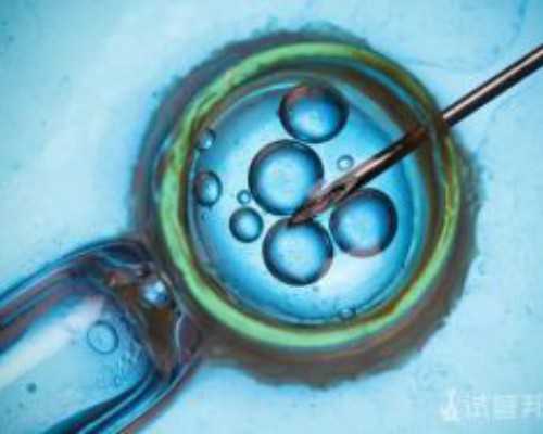 人工受孕的方法的方法有哪些 人工授精的过程介绍