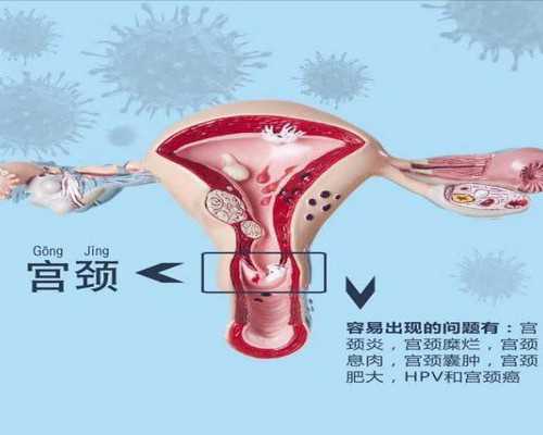 代生男孩大庆~子宫内膜息肉能喝酒吗 酒精真的这