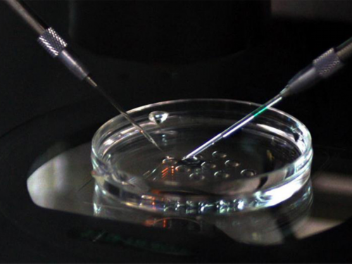 CA125偏高多少需要警惕