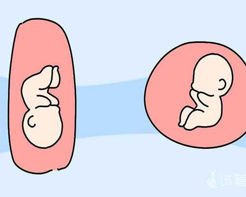 FSH促卵泡刺激素升高的原因及解决方法【助孕侠】