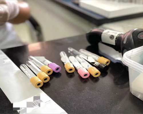 第三代试管移植囊胚后[中国试管婴儿]