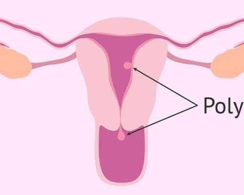 患者在生活中做好哪些保健有利于缓解病情呢-