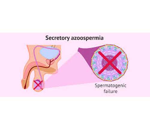 下半身越肿越易患上这种病