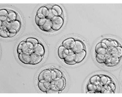 宫颈癌是怎样形成的