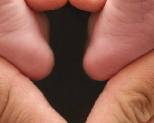 深圳有没有代怀的_“脸上动刀”说明心理有疾 要学会接受自己