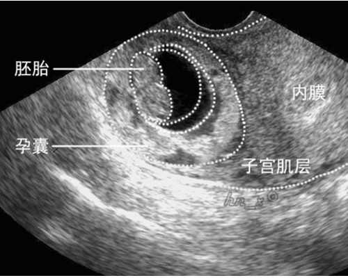 深圳代孕可靠吗-深圳代孕合法了没-深圳代怀孕代孕包成功