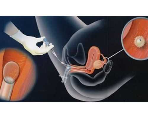 泰国代孕的价格:男人常吃4种“零嘴”,补充“