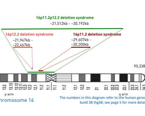 第三代试管代孕可以选男女吗:多卵巢综合征、