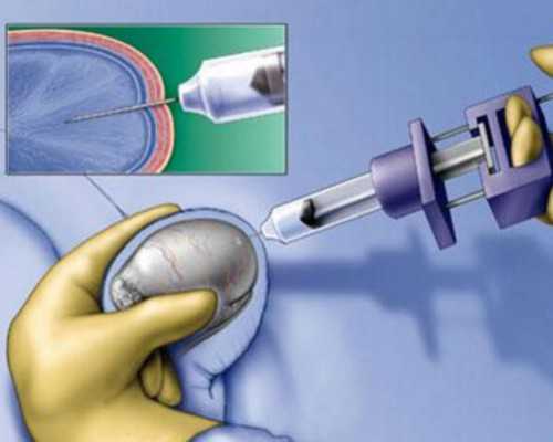 ---深圳一次代孕费-深圳代孕是自己的孩子吗-最靠谱代孕网三伏贴真的有效果吗