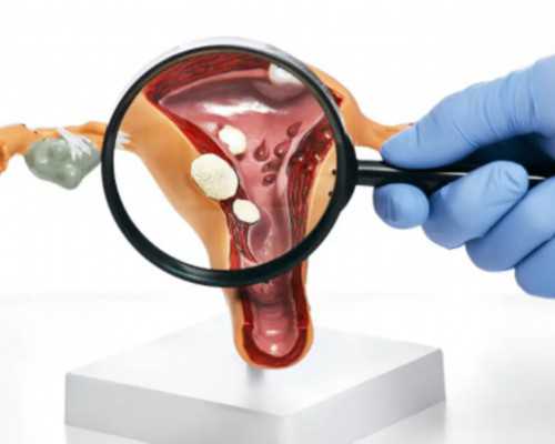 深圳代孕-深圳代孕是多少合适-深圳医院做代孕哪些手续