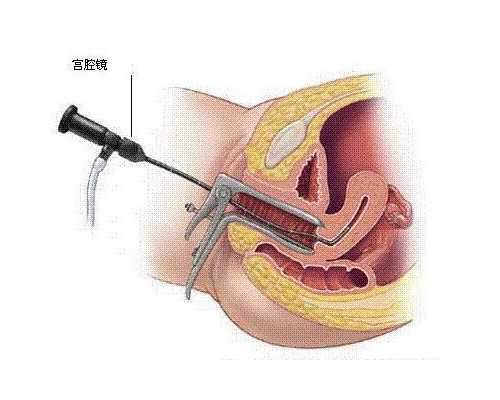 怀孕前，请先检查甲状腺