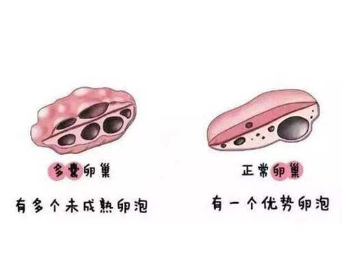 二代试管婴儿畸形率高吗_第一次使用非妈助孕法