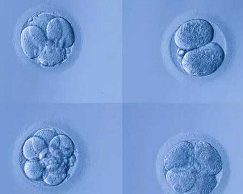 射精过快一定是早泄吗?