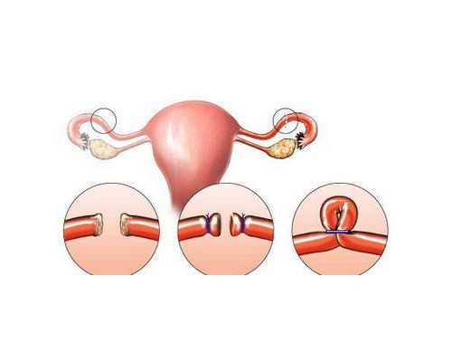 深圳谁想找代孕-深圳在哪找代孕志愿者-孕妈保健备孕注意事项