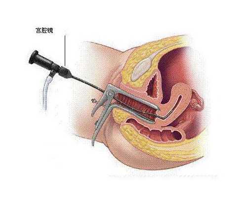 深圳代孕产子价格-深圳代孕一般要多少钱-C14检查是什么