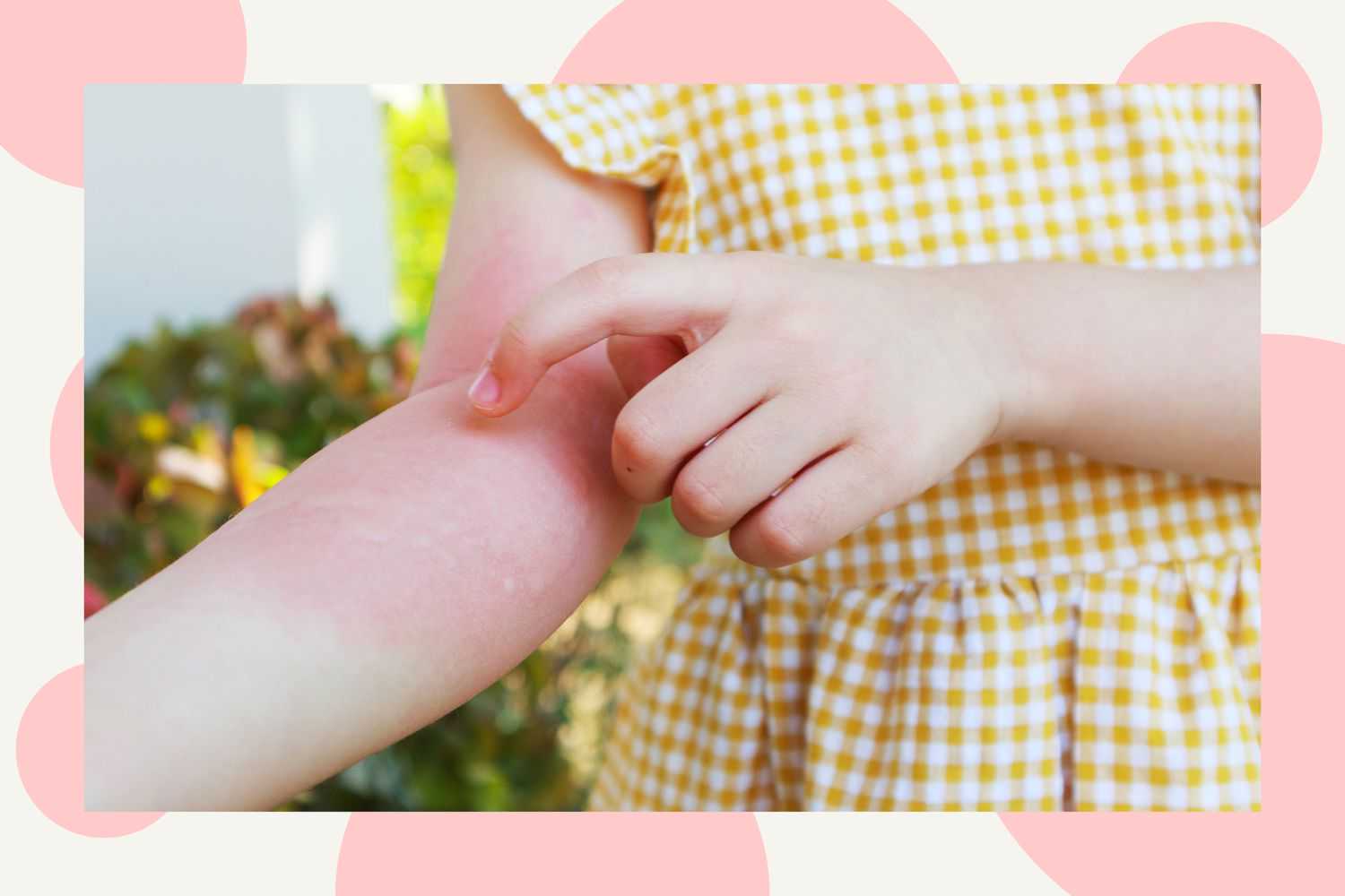 中国正规供卵机构,哪里可以做捐卵试管婴儿