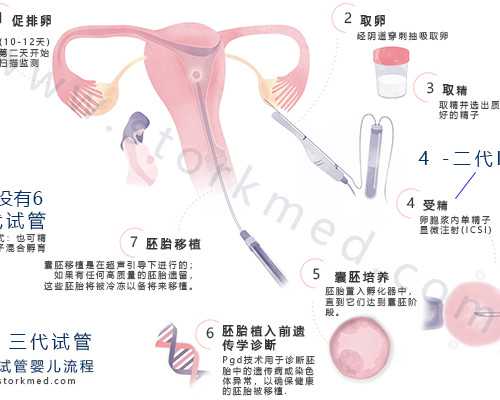 深圳代孕价格_深圳去哪里找代孕_代孕初期可以吃