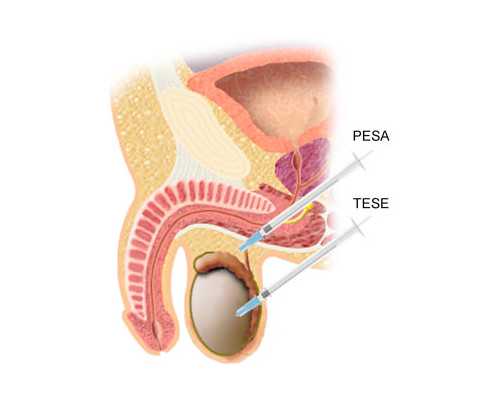 2020代妈招聘怎么联系_代孕三个月胸还会涨疼吗