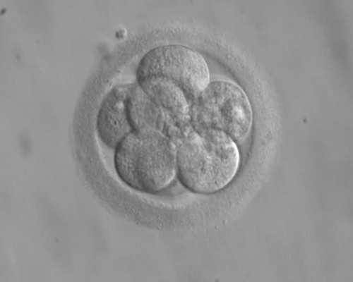 中国允许试管婴儿选性别吗,澳门爱维医疗中心做试管婴儿可以选性别吗？