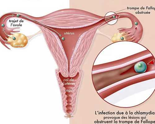 做试管婴儿饮食注意事项
