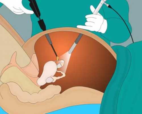 供卵试管技术优势,助孕机构代怀产子