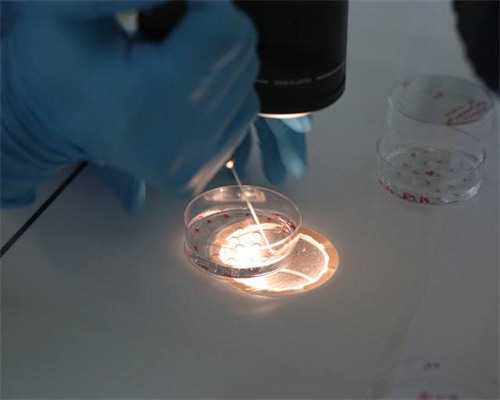 染色体有问题五个手指长短有啥关系?