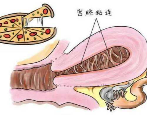 深圳代生男孩价格表,深圳那里代孕最权威