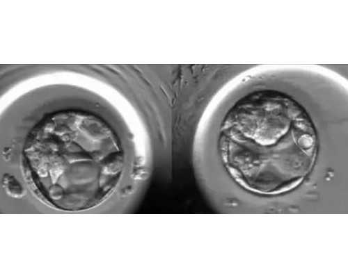 哪里找供卵试管联系方式_代怀小孩哪里便宜