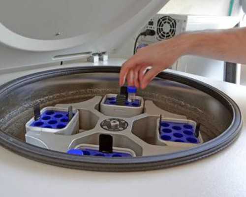 【试管助孕指南】多囊卵巢会影响试管移植着床的成功率吗?