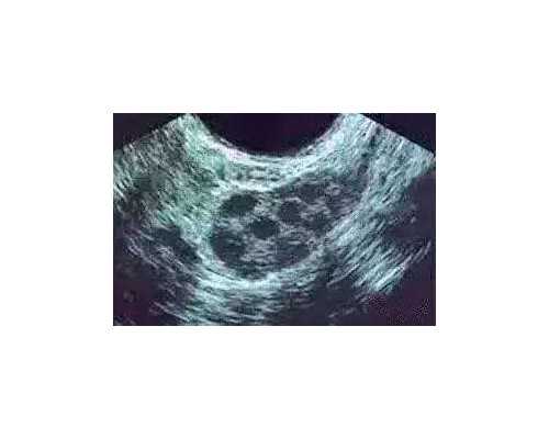 深圳代孕多少钱-深圳哪里代孕【深圳科学代孕零风险包成功】